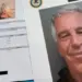 La normalizzazione di Epstein